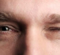 Sausų akių sindromas